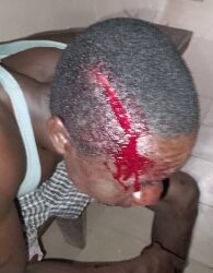 Man Killed For Stealing Torch Light