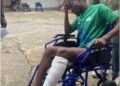 Devastating Injury Strikes FC Kallon Midfielder in Friendly Match