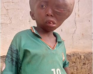 With Health Complications… 15-Year-Old Boy Cries for Help