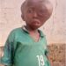 With Health Complications… 15-Year-Old Boy Cries for Help
