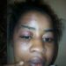 Aminatu Barrie Suffers Horrific Abuse; Police Didn’t Take Case Serious & Her Life Is In Danger